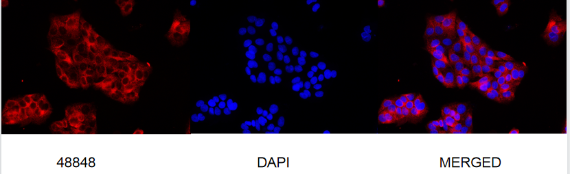 PI 3 Kinase p85 alpha Rabbit mAb