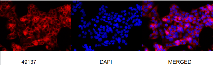 pro Caspase 7 Rabbit mAb