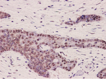 Cullin 4a Rabbit mAb - SAB | Signalway Antibody