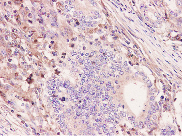 Arp3 Rabbit mAb