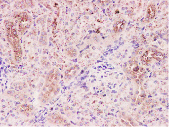 Arp3 Rabbit mAb