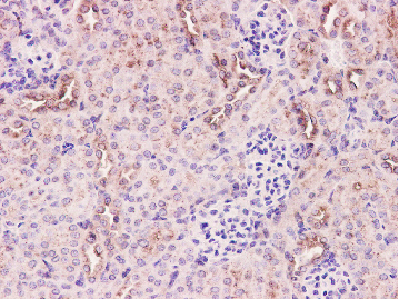 Arp3 Rabbit mAb