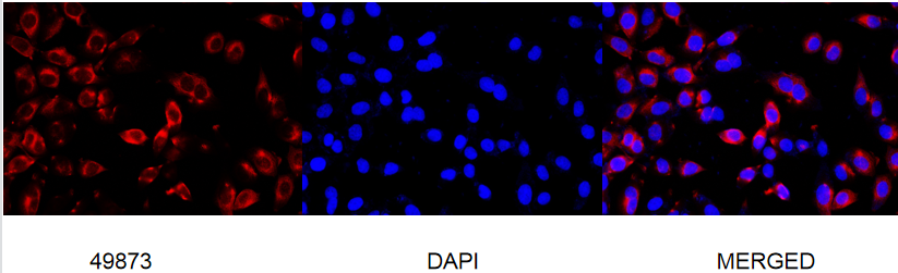 Arp3 Rabbit mAb