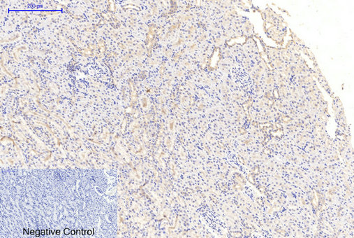 GSK3α/β(Phospho-Tyr279/216) Antibody