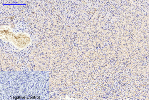 GSK3α/β(Phospho-Tyr279/216) Antibody