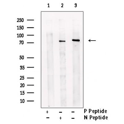 SYK (Phospho-Tyr352) Antibody