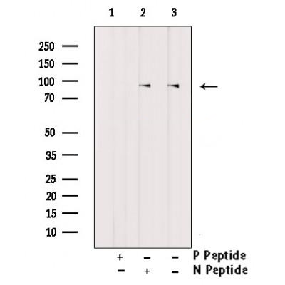 FGFR4 (Phospho-Tyr642) Antibody