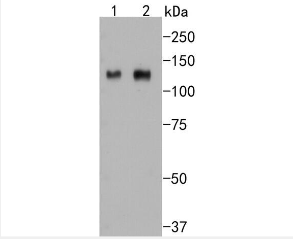 Integrin beta 3 Rabbit mAb