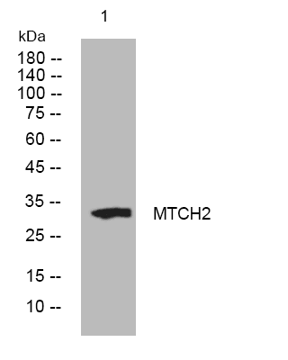 MTCH2 rabbit polyclonal antibody