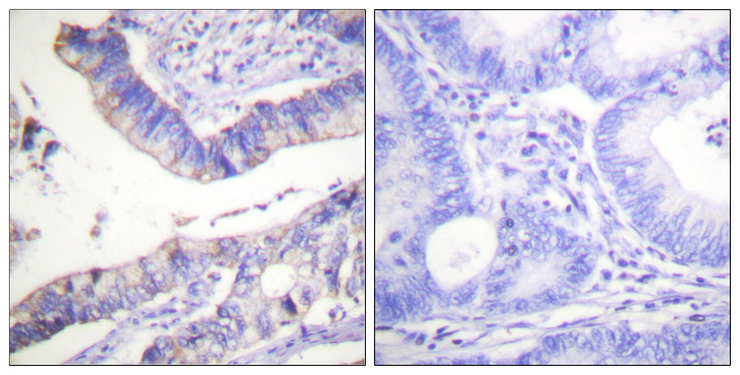 BCL2 Antibody