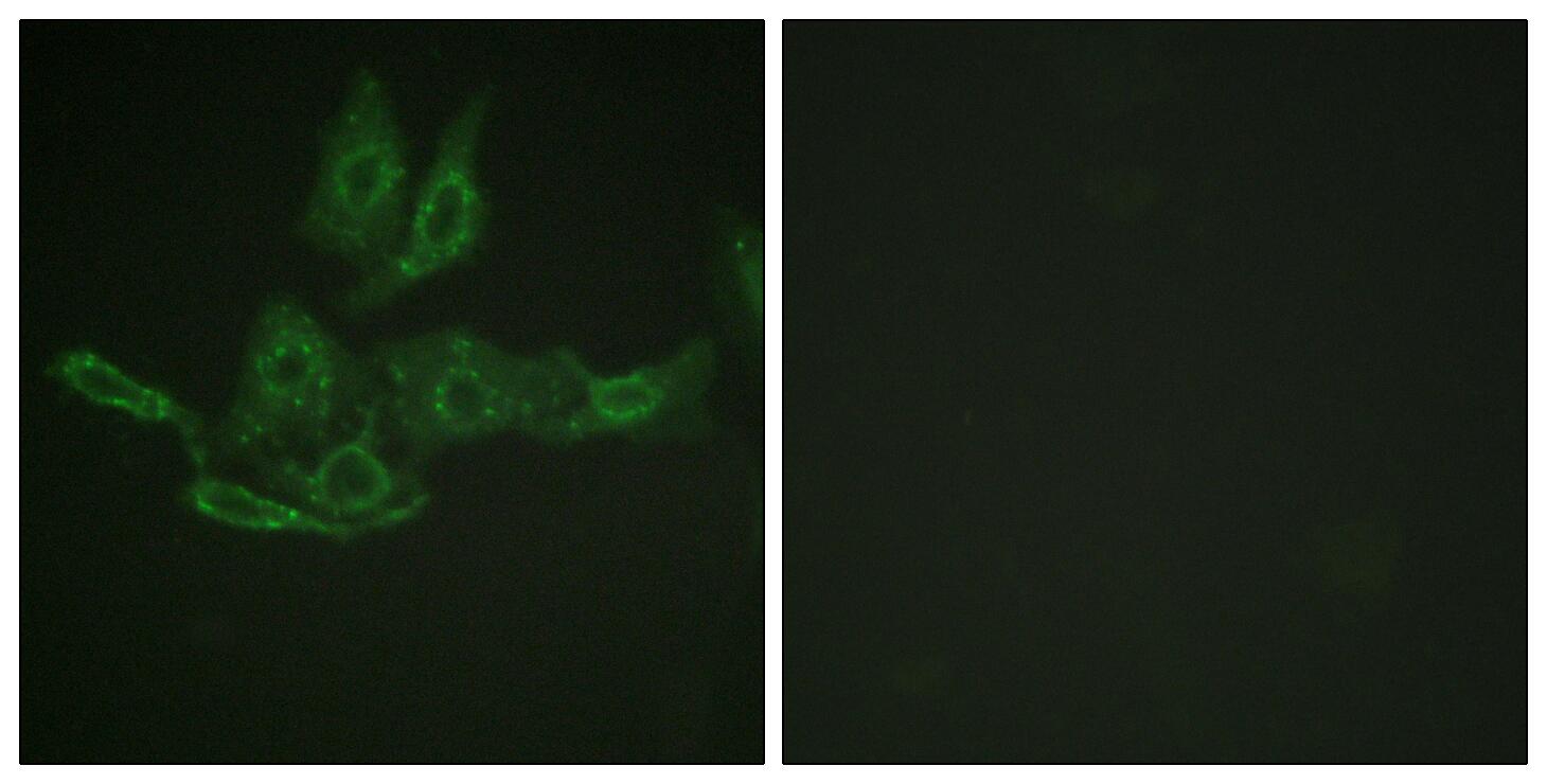 BCL2 Antibody