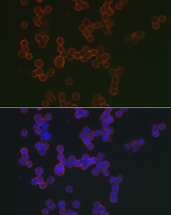 MS4A1 antibody