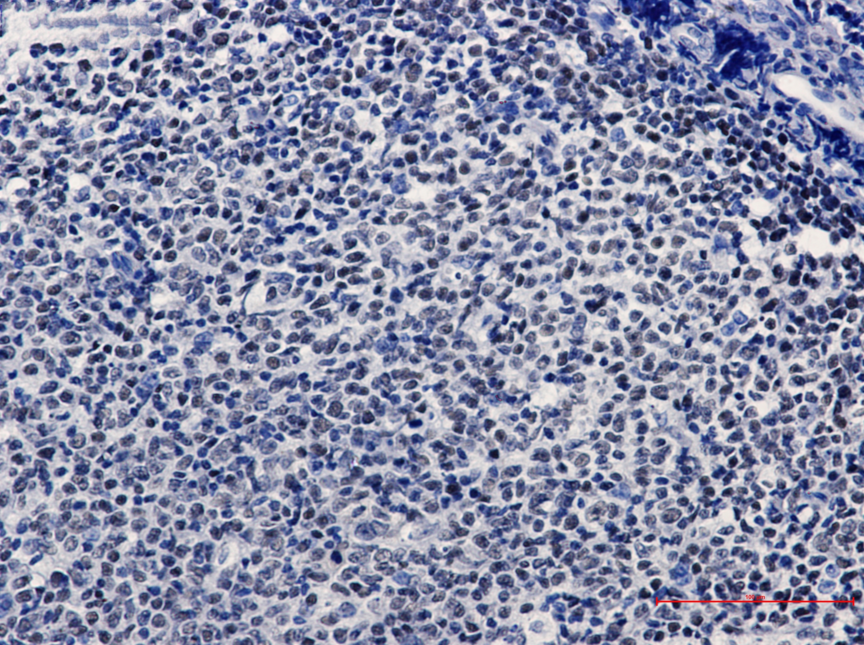 KAT1 Rabbit mAb