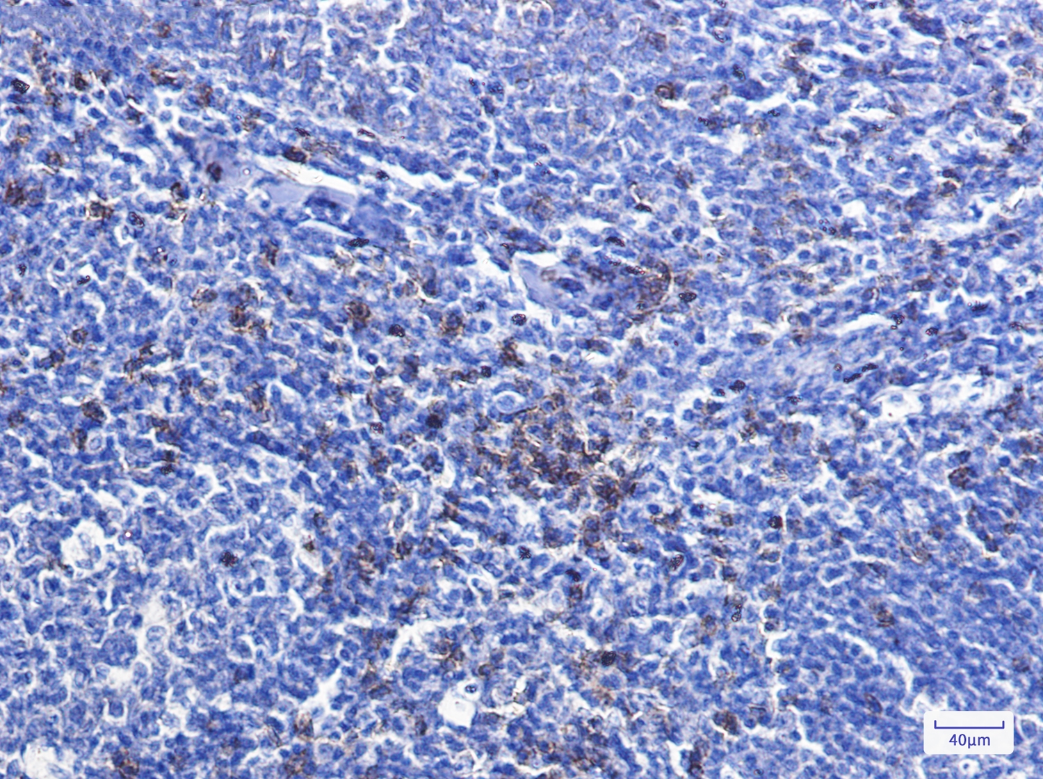 CD8 alpha Rabbit mAb