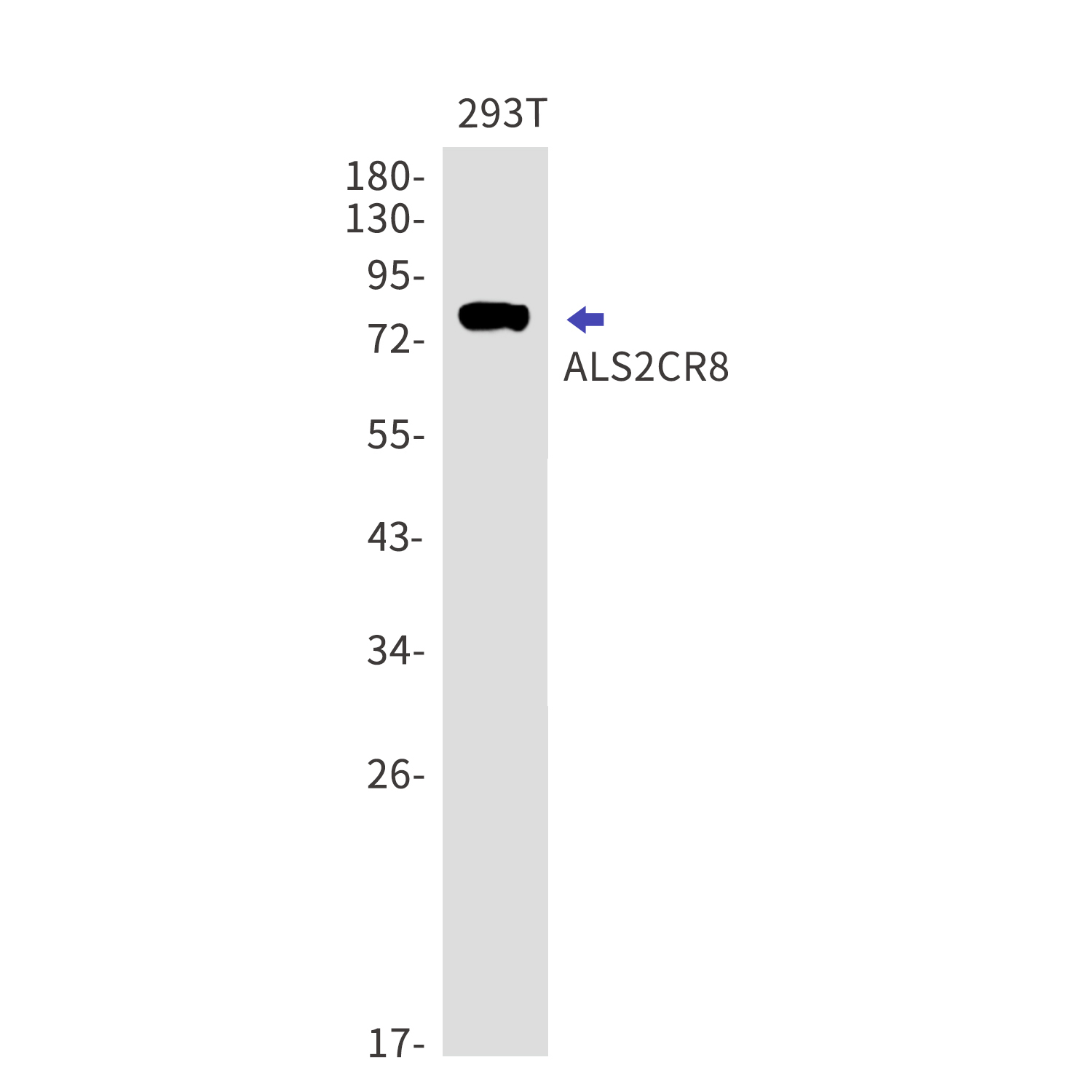 ALS2CR8 Rabbit mAb