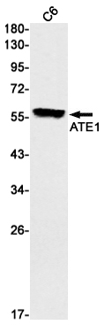ATE1 Rabbit mAb