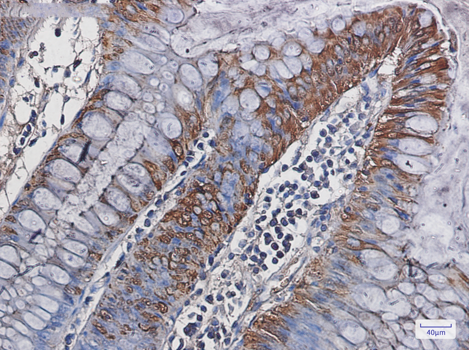 Carbonic Anhydrase 1 Rabbit mAb