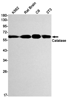 Catalase Rabbit mAb