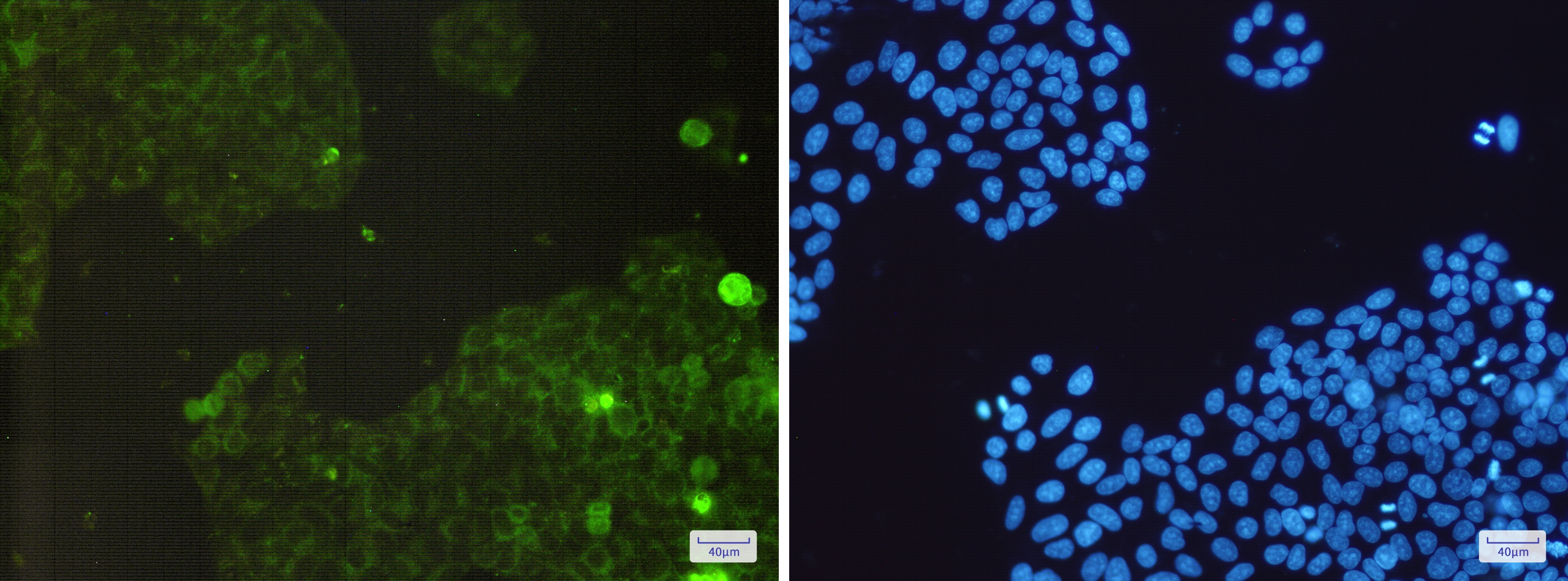 Catalase Rabbit mAb