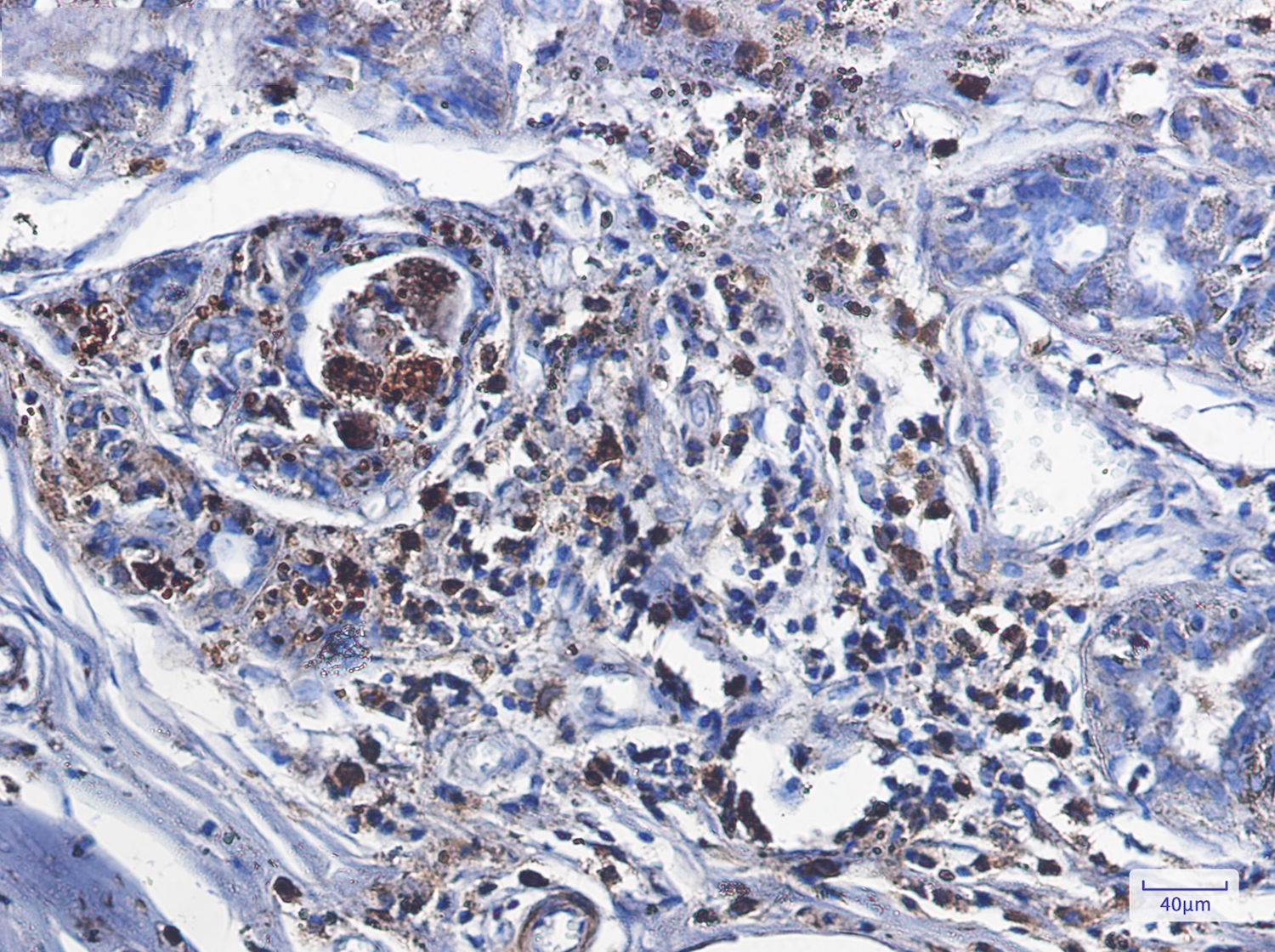 Catalase Rabbit mAb