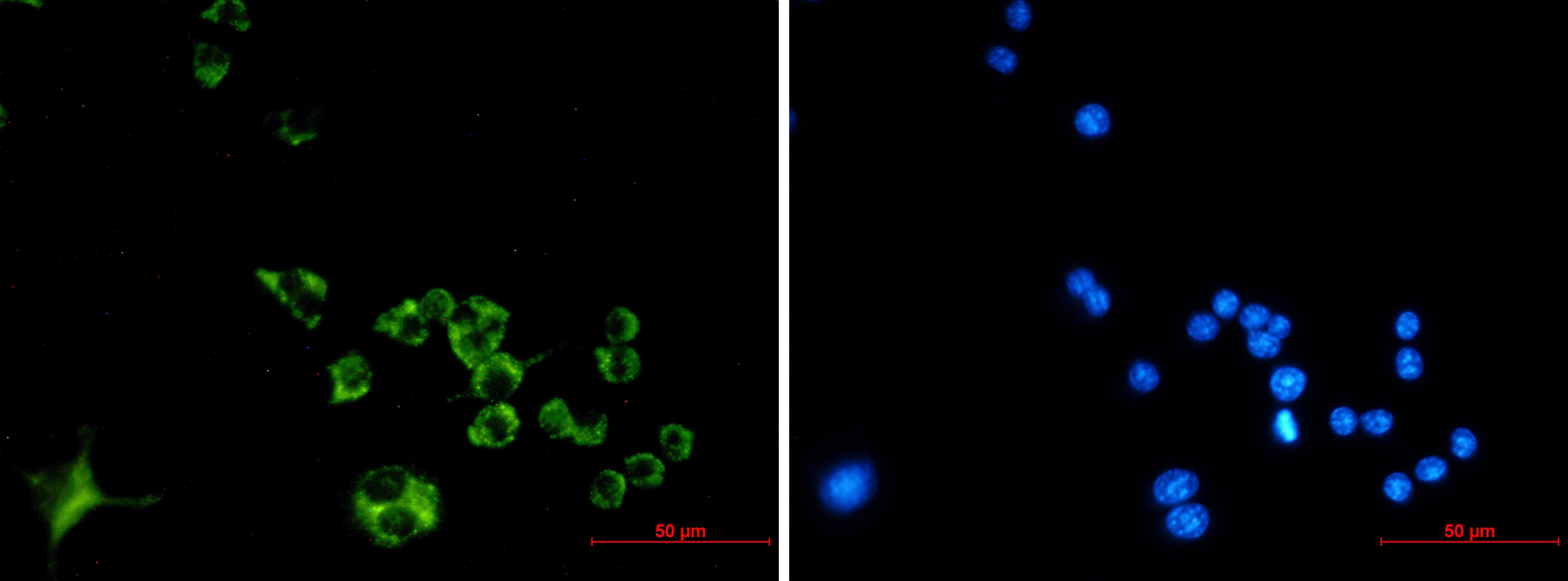 Cathepsin B Rabbit mAb