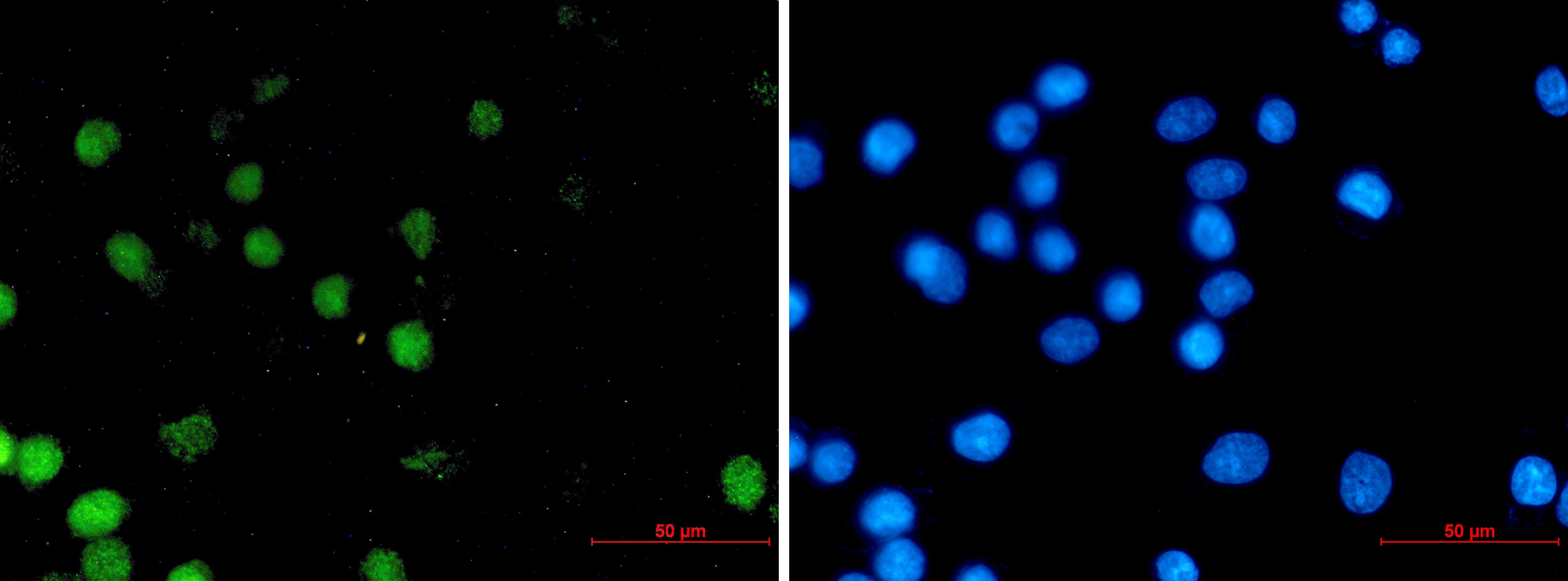 FOXA1 Rabbit mAb