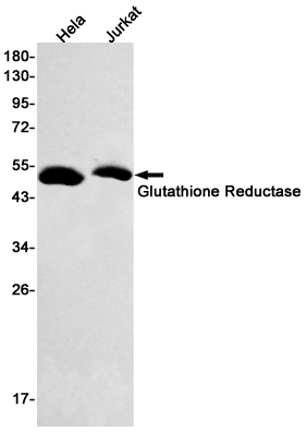 Glutathione Reductase Rabbit mAb