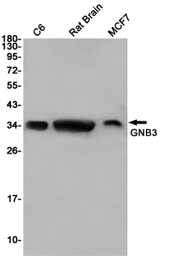 GNB3 Rabbit mAb