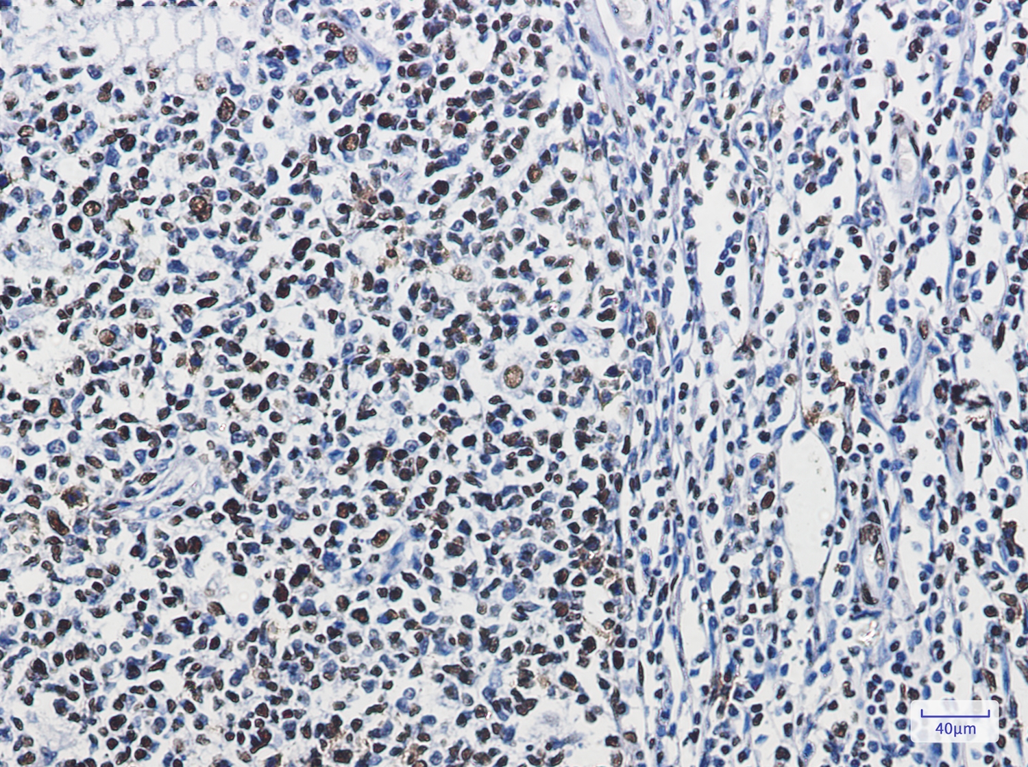 hnRNP M Rabbit mAb