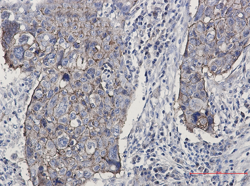 Junctional Adhesion Molecule 1 Rabbit mAb