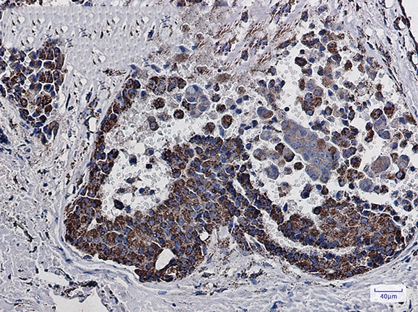 MDH2 Rabbit mAb