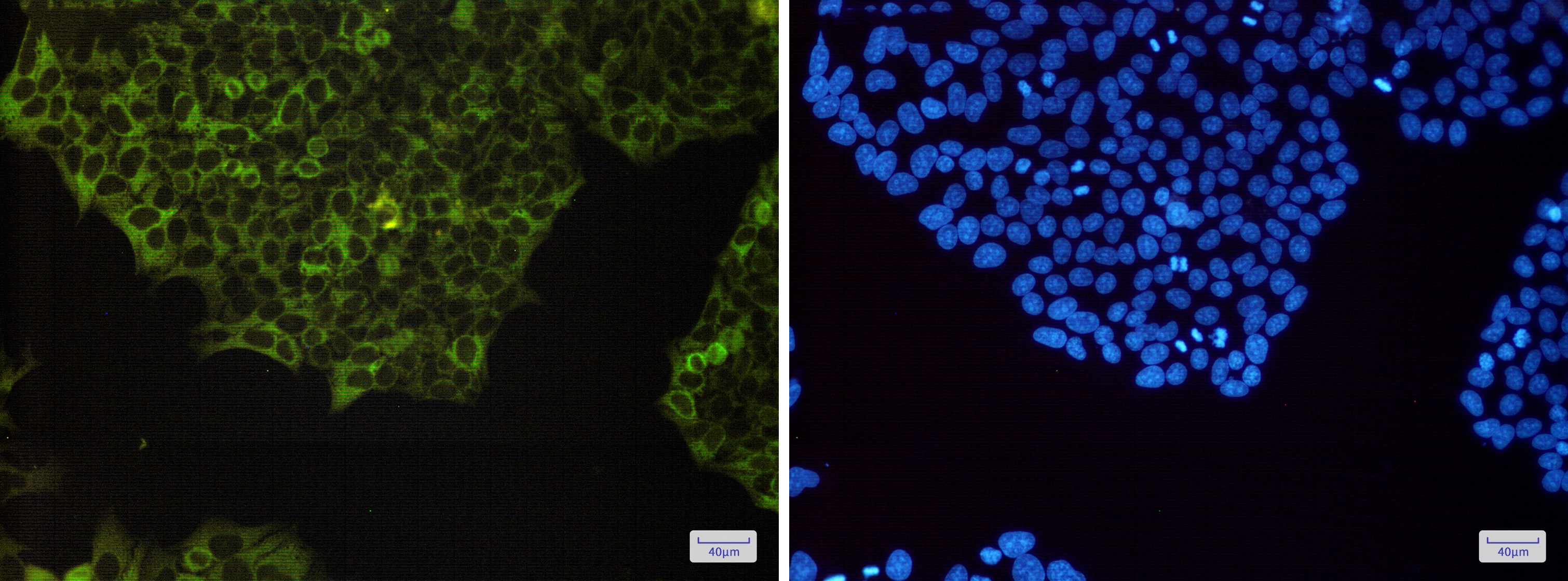 NF kappa B p100 Rabbit mAb