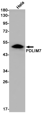 PDLIM7 Rabbit mAb