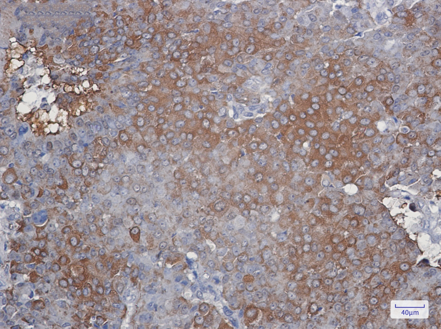 Peroxiredoxin 2 Rabbit mAb