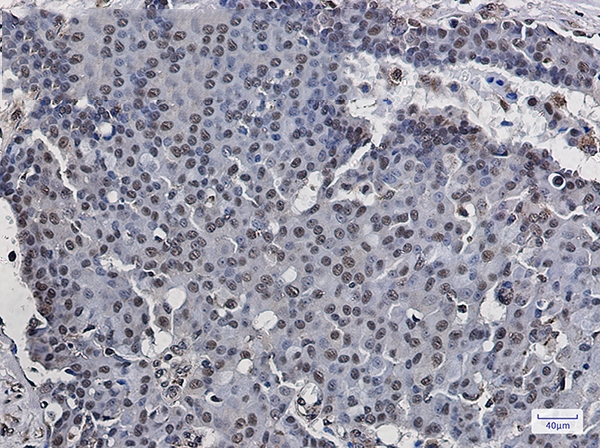 RNA Polymerases I/II/III Subunit ABC1 Rabbit mAb