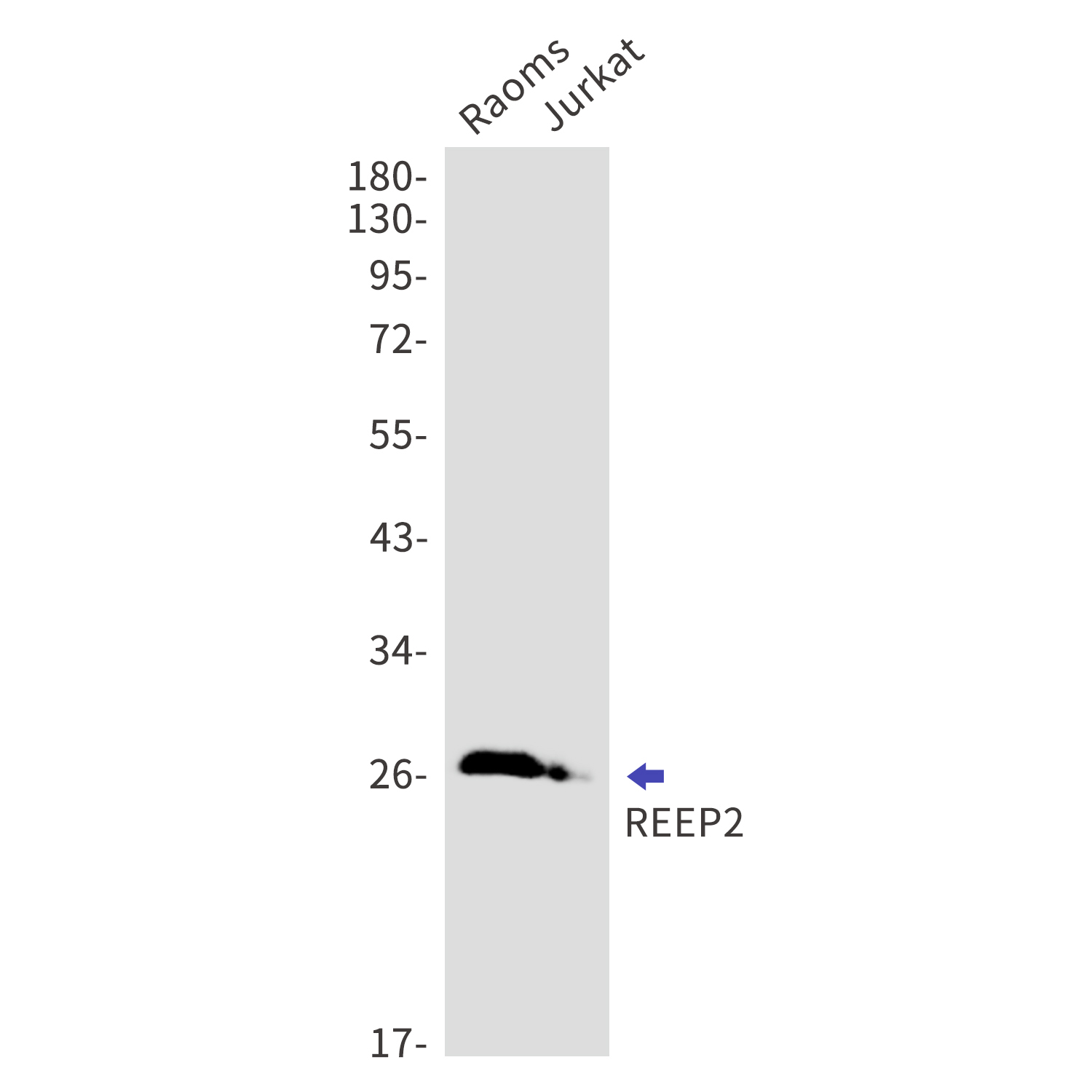 REEP2 Rabbit mAb