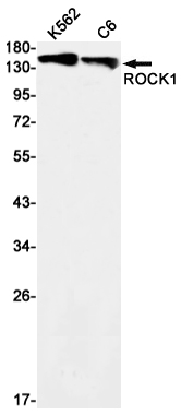 ROCK1 Rabbit mAb