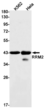 RRM2 Rabbit mAb