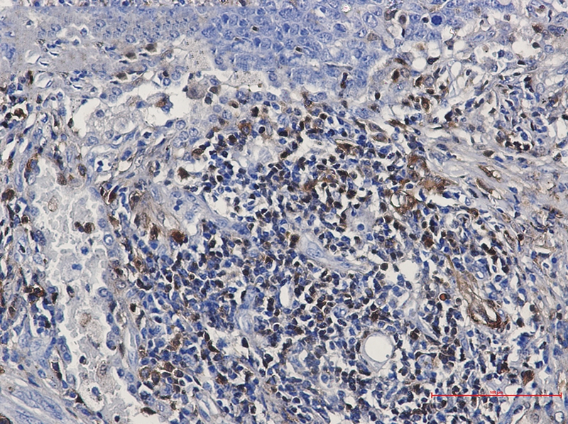 S100A4 Rabbit mAb