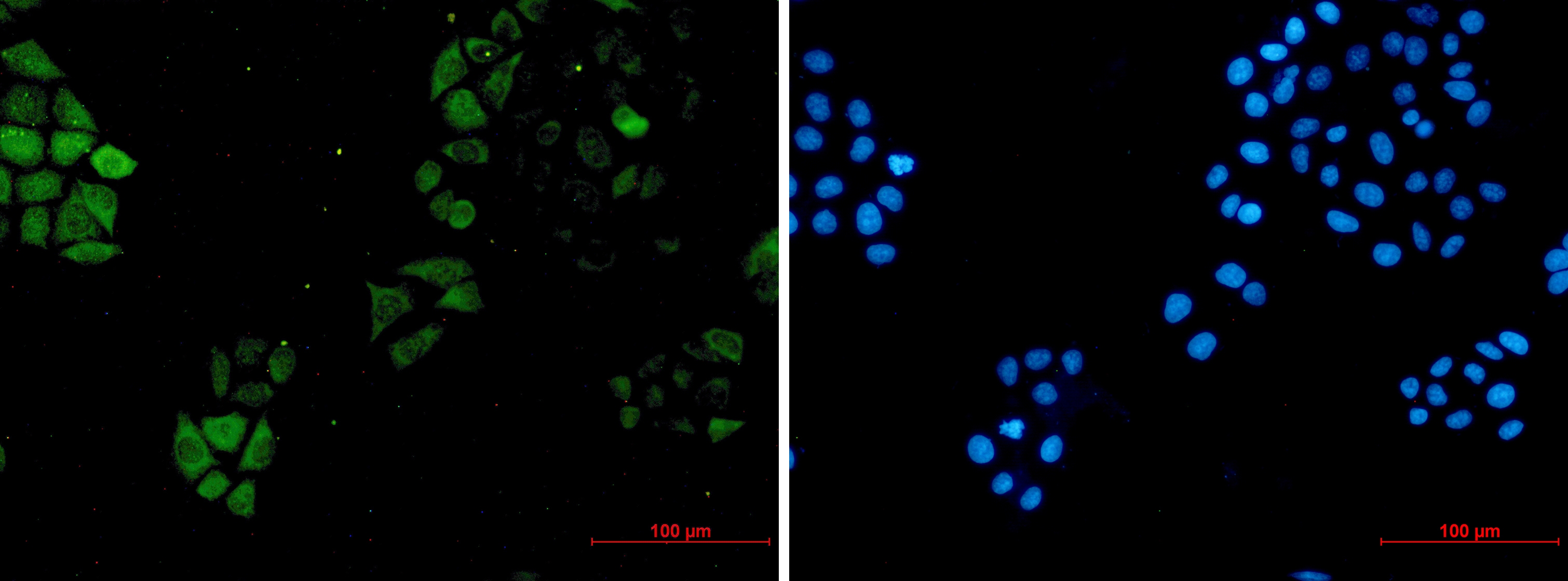 S100A4 Rabbit mAb