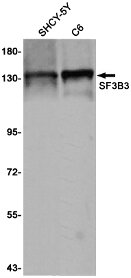 SF3B3 Rabbit mAb