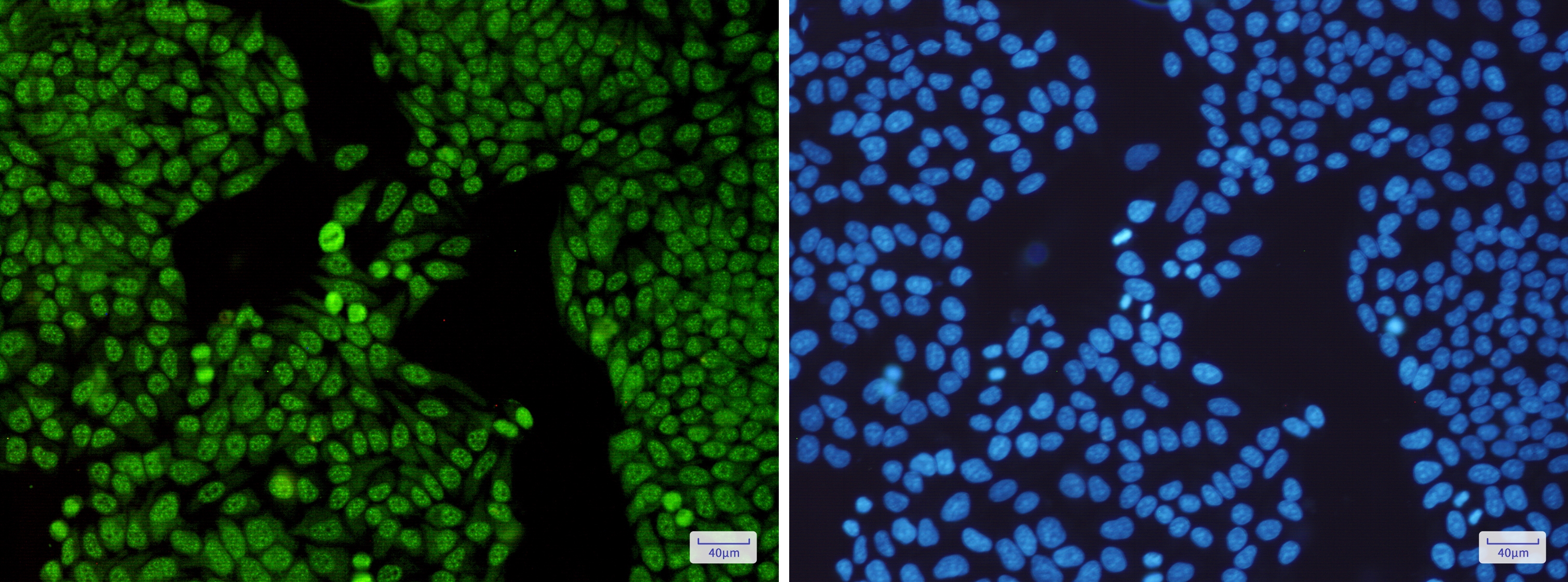 SF3B3 Rabbit mAb