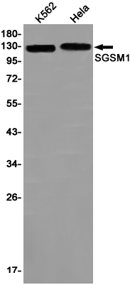 SGSM1 Rabbit mAb