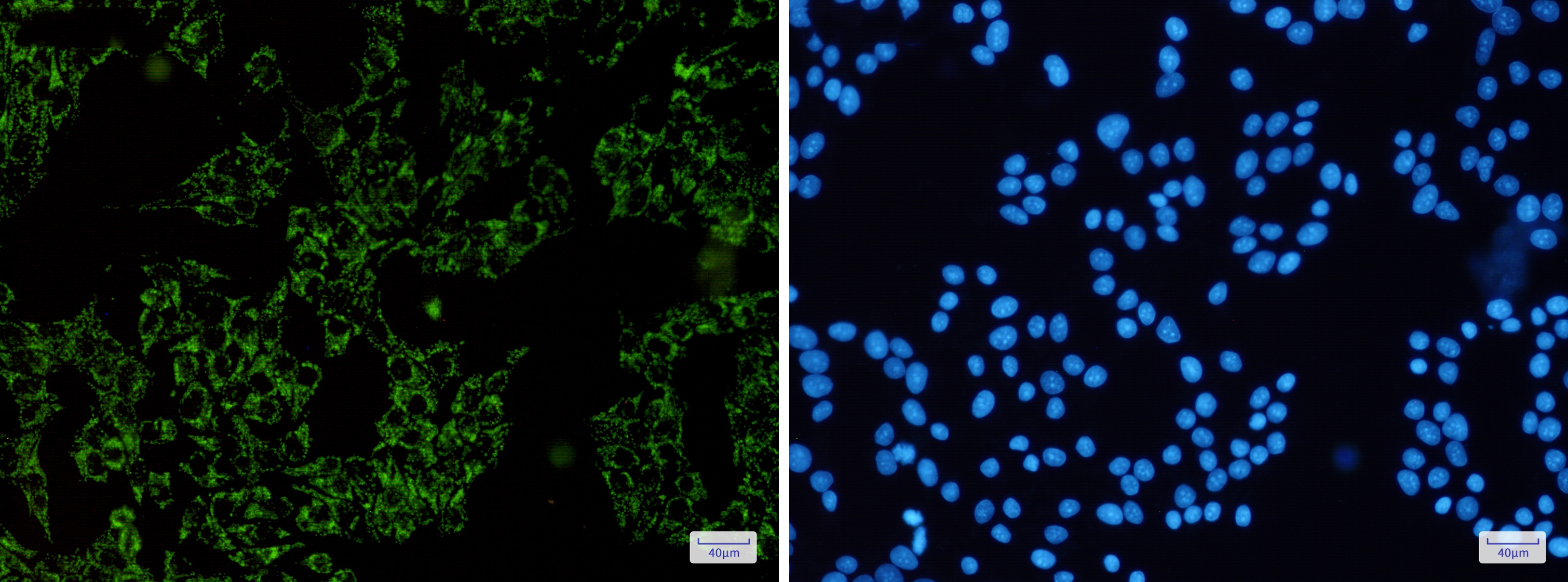 SGSM1 Rabbit mAb
