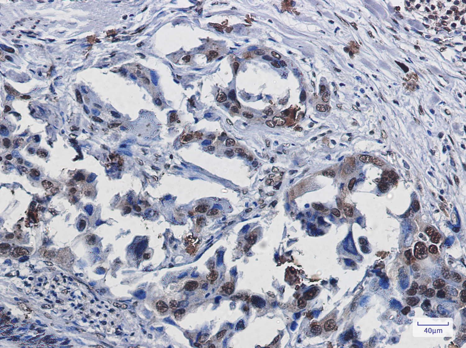 SUMO1 Rabbit mAb