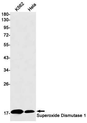 Superoxide Dismutase 1 Rabbit mAb