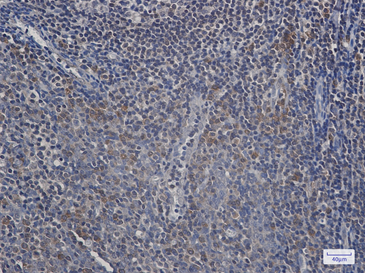 UFC1 Rabbit mAb