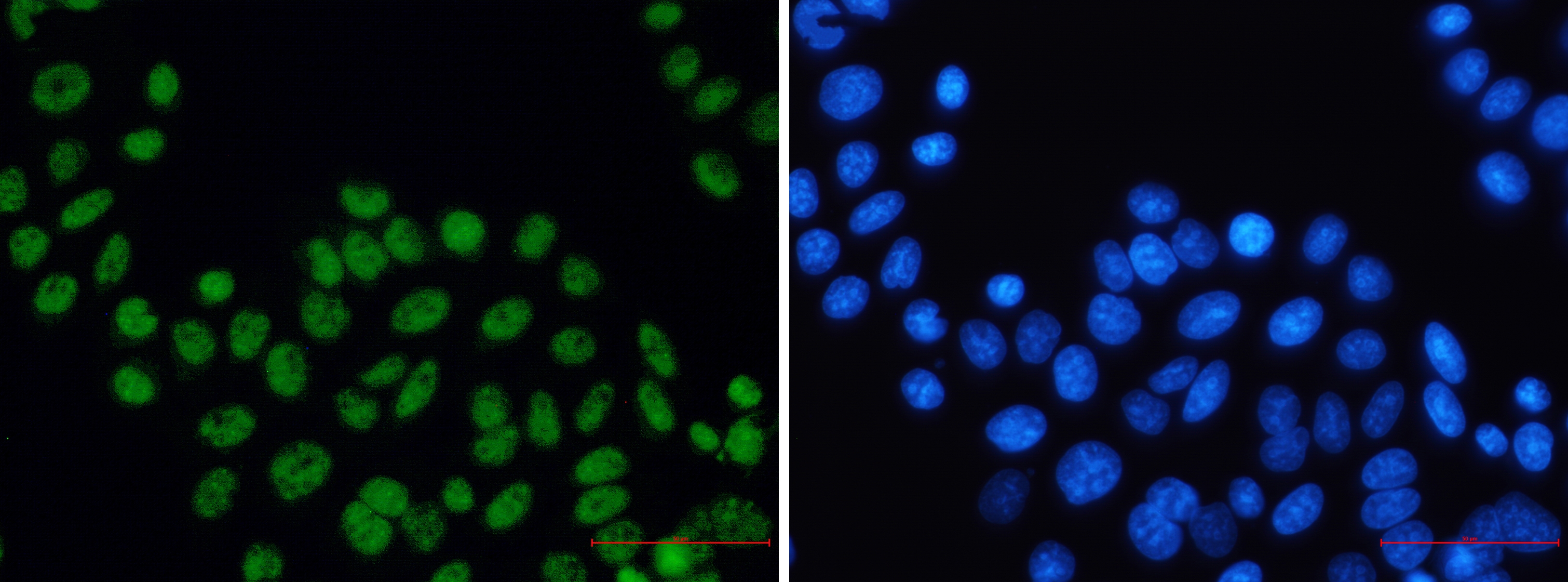 XPD Rabbit mAb