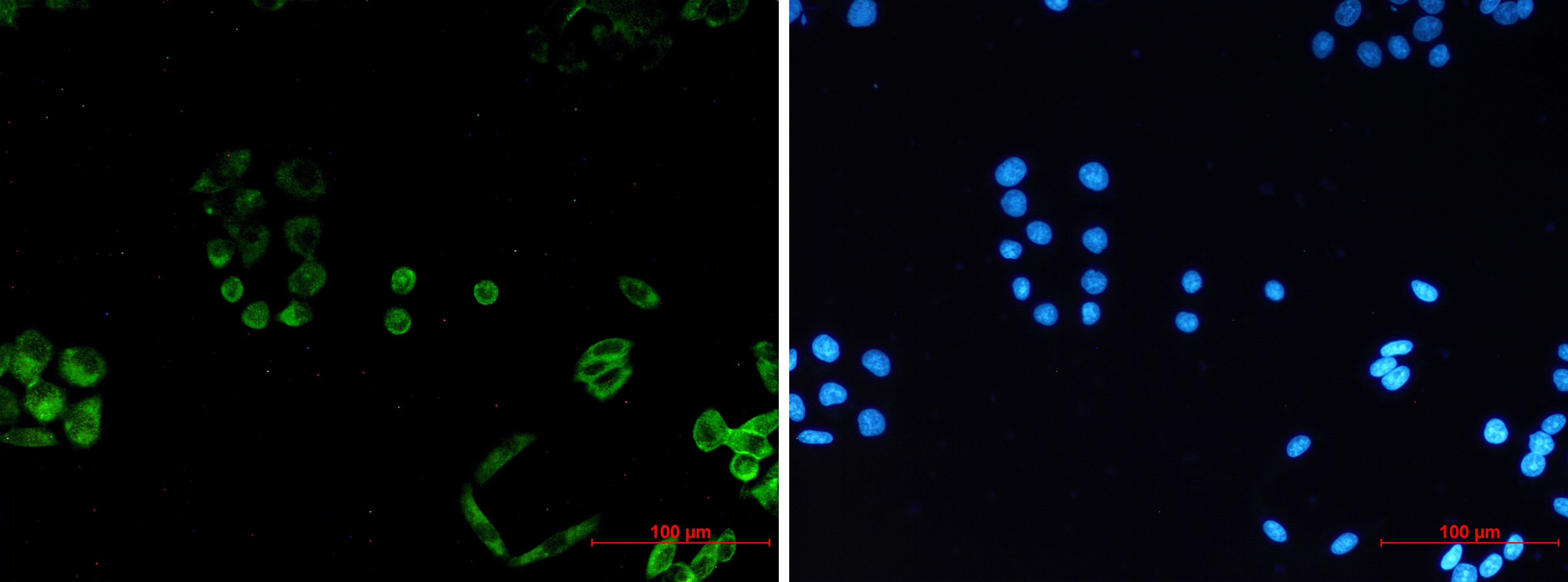 PACSIN3 Rabbit mAb