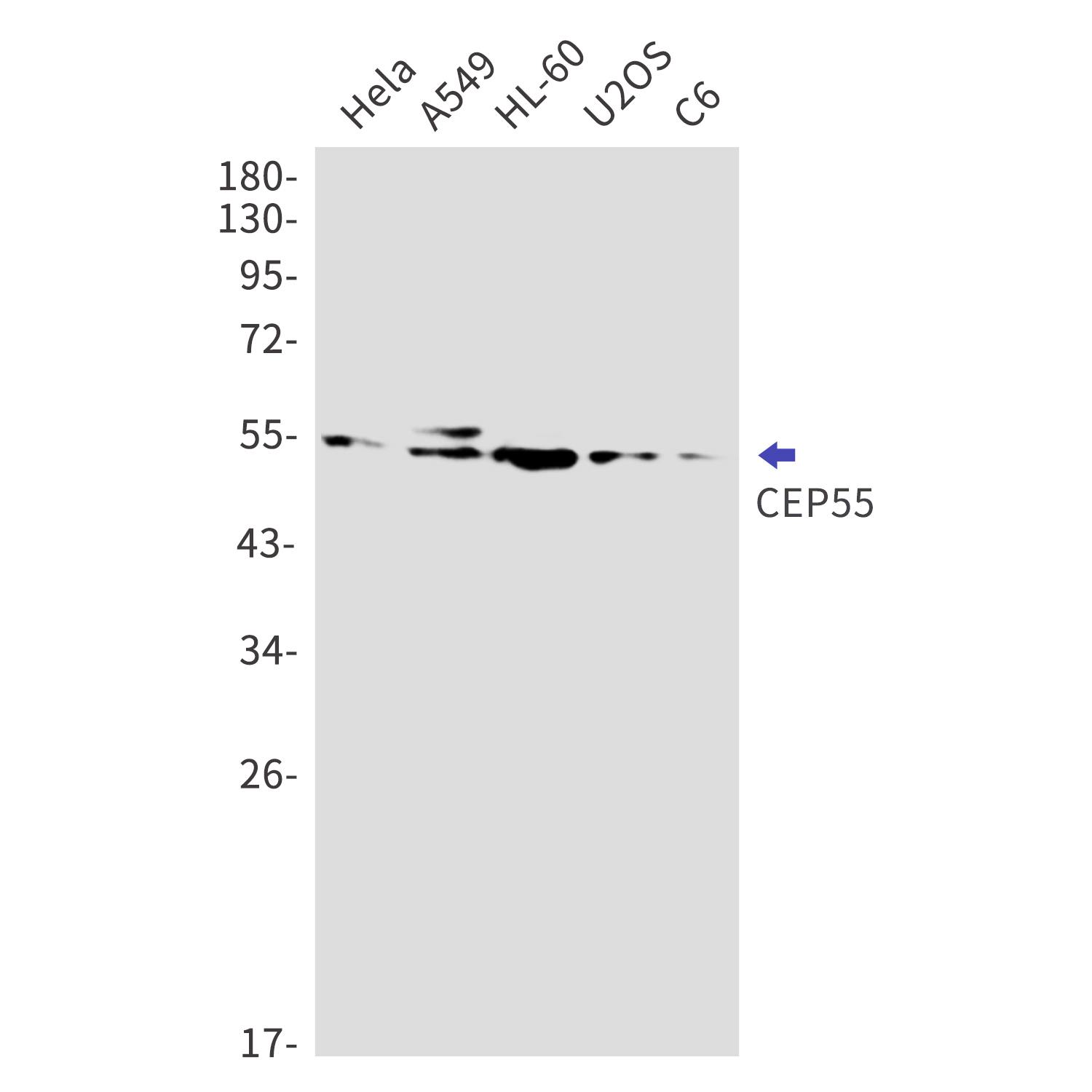 CEP55 Rabbit mAb